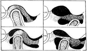 Dolor orofacial