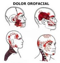Dolor orofacial